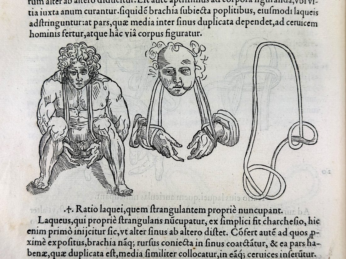 Chirurgia e Graeco in Latinum conversa — 10