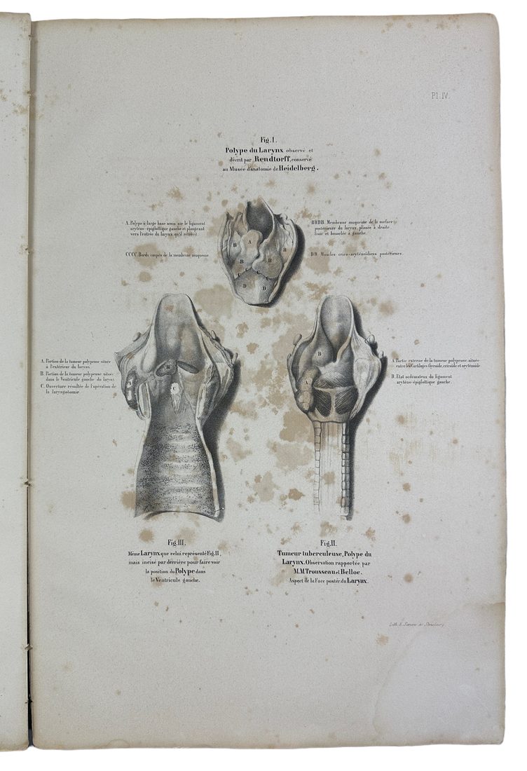 Musee d'anatomie de la faculte de medecine de Strasbourg : histoire des polypes du larynx — 1