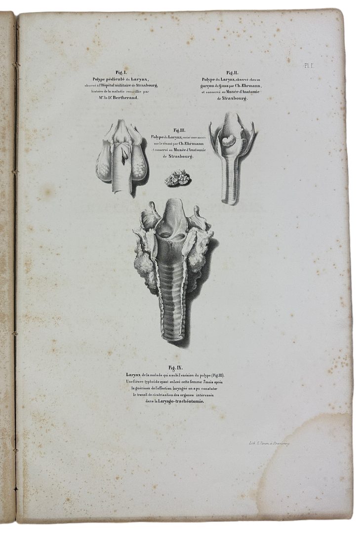 Musee d'anatomie de la faculte de medecine de Strasbourg : histoire des polypes du larynx — 5