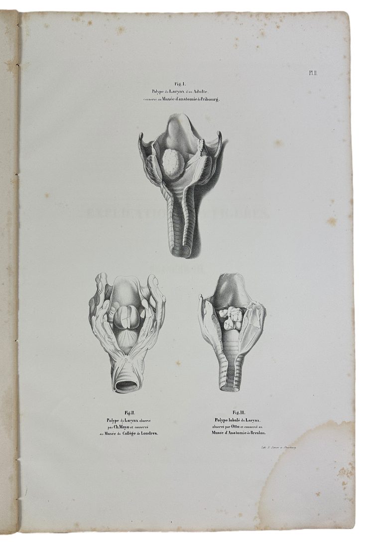 Musee d'anatomie de la faculte de medecine de Strasbourg : histoire des polypes du larynx — 6