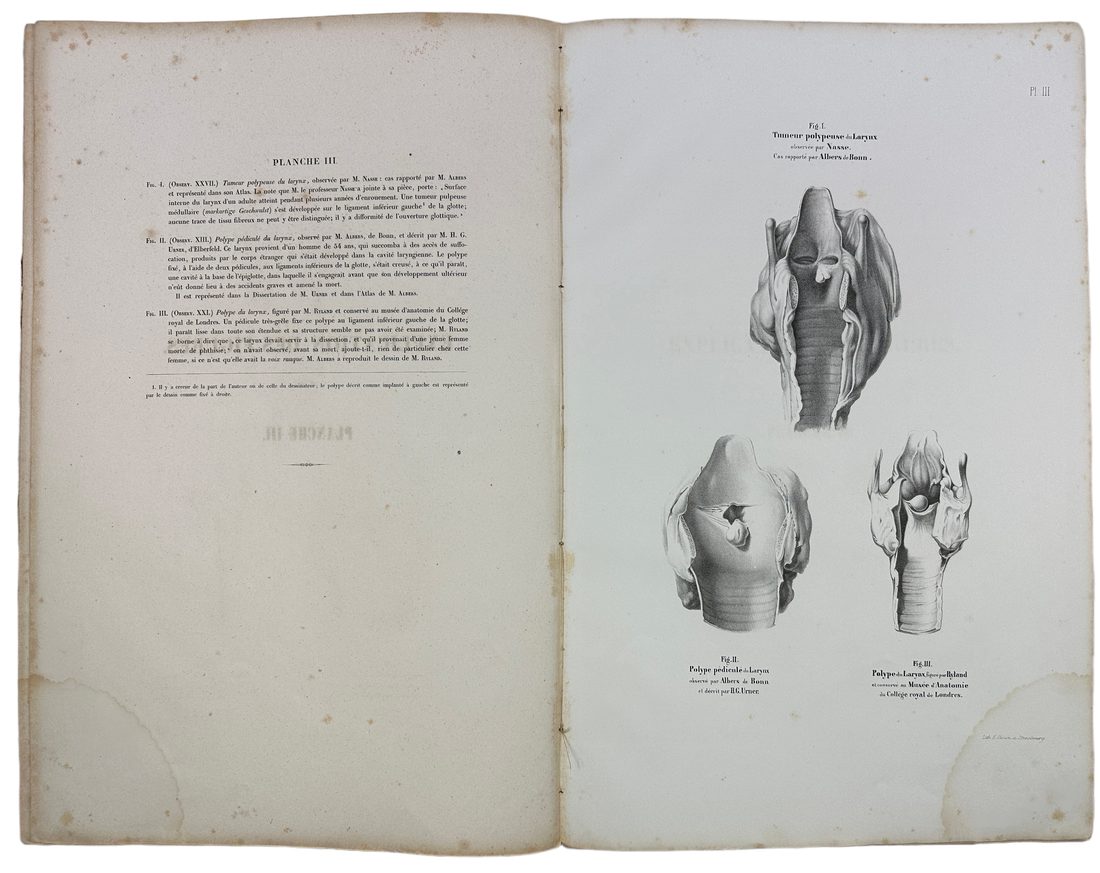 Musee d'anatomie de la faculte de medecine de Strasbourg : histoire des polypes du larynx — 7