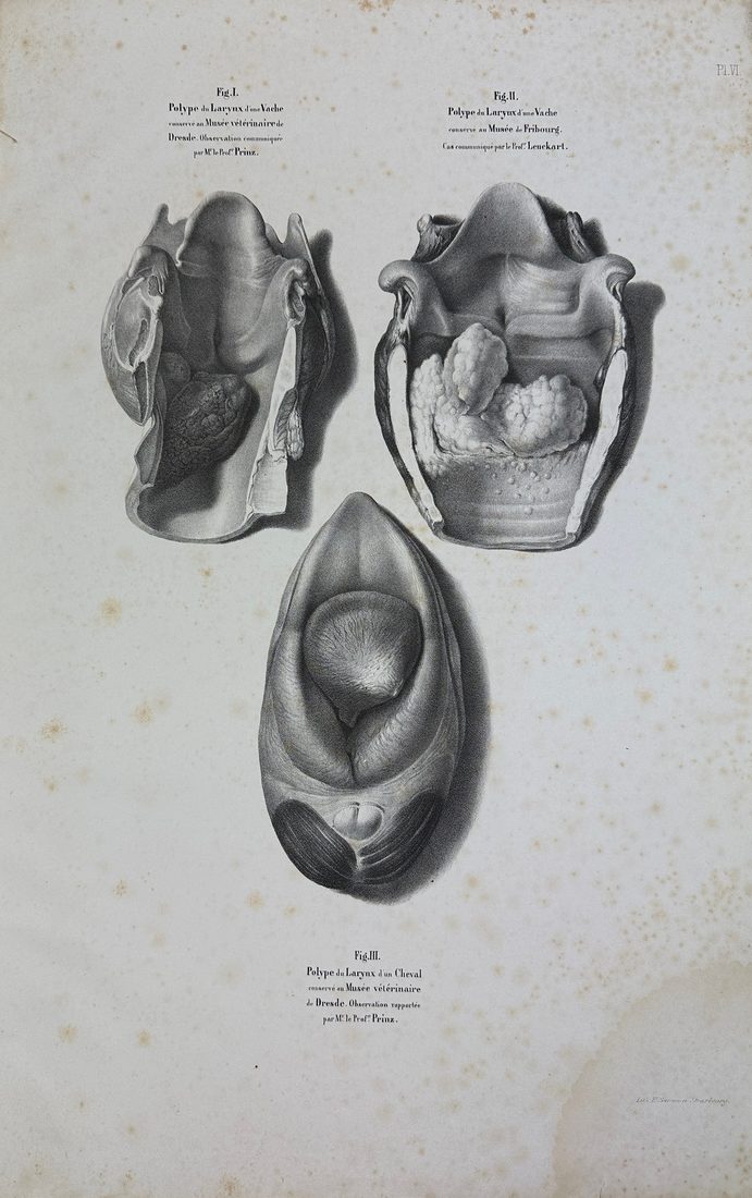 Musee d'anatomie de la faculte de medecine de Strasbourg : histoire des polypes du larynx — 10
